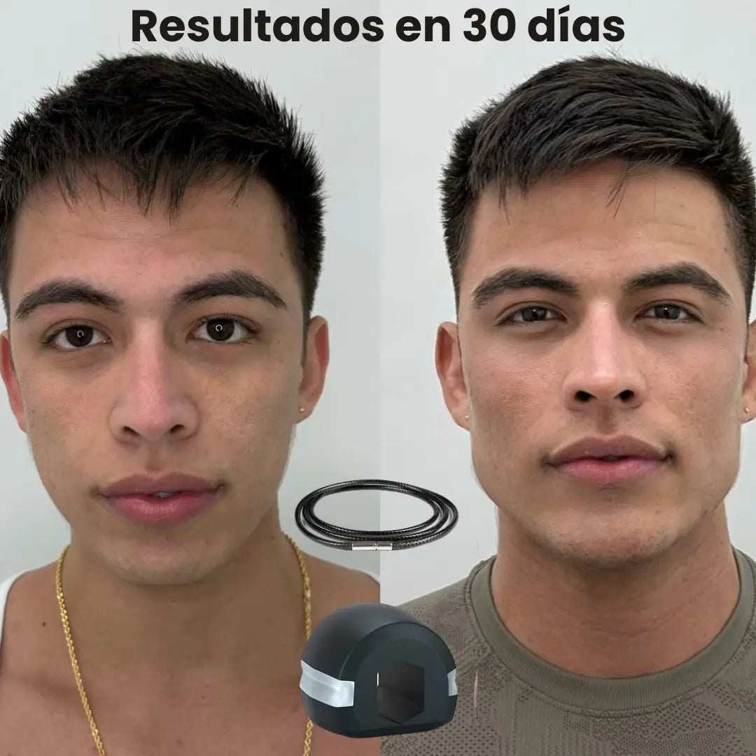 Ejercitador de músculos faciales  en gel de sílice: mandíbula perfilada en 30 días