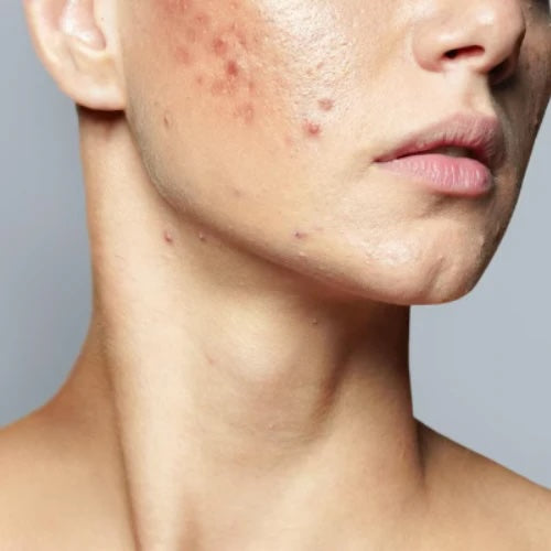 MOISTURE CUSHION™ BASE MAQUILLAJE Y CANDY BELLA POLVO